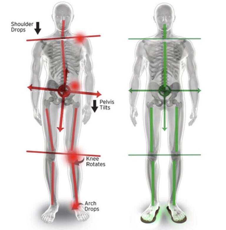 Human Skeleton