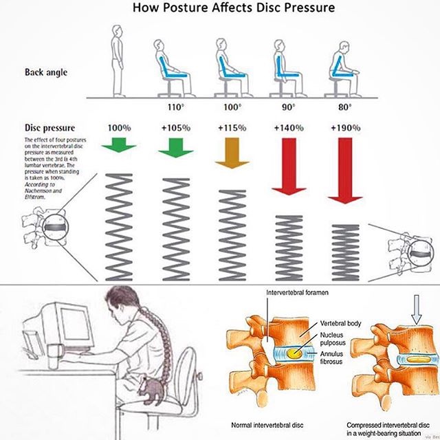 poor posture